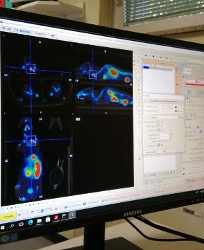 PC PET Ospedale San Raffaele